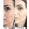 DermEden-Koncentratas-mazinti-randelius-pigmentacija-TXA3_-ANTI-DARK-SPOTS-CONCENTRATE DermEden TXA 3% Koncentratas Mažinti Pigmentaciją
