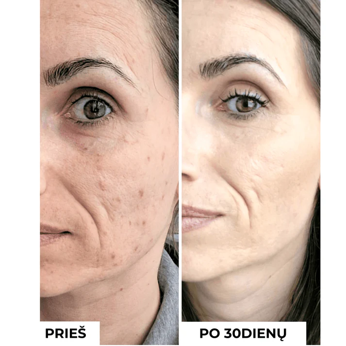 DermEden-Koncentratas-mazinti-randelius-pigmentacija-TXA3_-ANTI-DARK-SPOTS-CONCENTRATE DermEden TXA 3% Koncentratas Mažinti Pigmentaciją