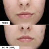 Veido-prausiklis-su-salicilo-rugstimi-DERMEDEN-PURIFYING-CLEANSING-GEL-2_ebf6cb32-92ce-4cfb-8072-a0672fb939da (1) DermEden TXA 3% Koncentratas Mažinti Pigmentaciją
