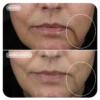 Image SkinCare, VOLULIFT, 4D veido apimties atkūrimo kompleksas