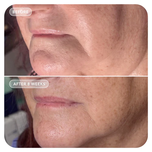 Image SkinCare, VOLULIFT, 4D veido apimties atkūrimo kompleksas